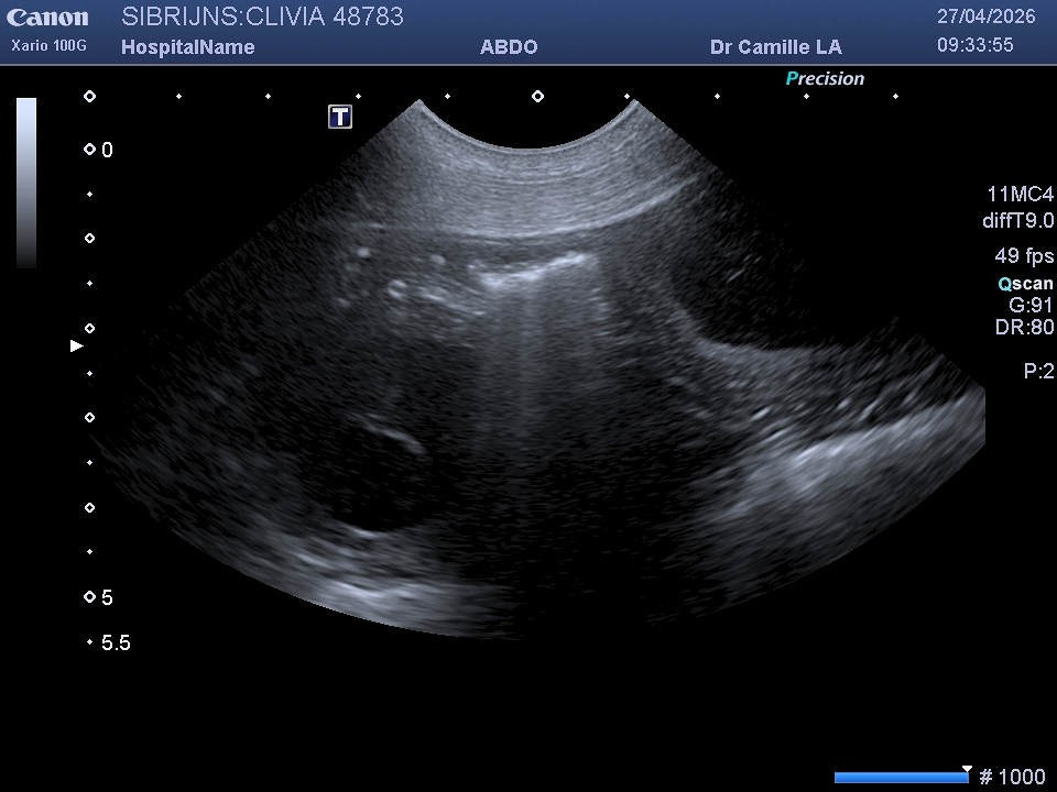 Echographie de Clivia